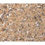 Immunohistochemistry - LONP1 Antibody from Signalway Antibody (40199) - Antibodies.com