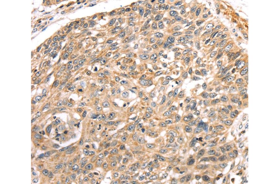 Immunohistochemistry - LONP1 Antibody from Signalway Antibody (40199) - Antibodies.com