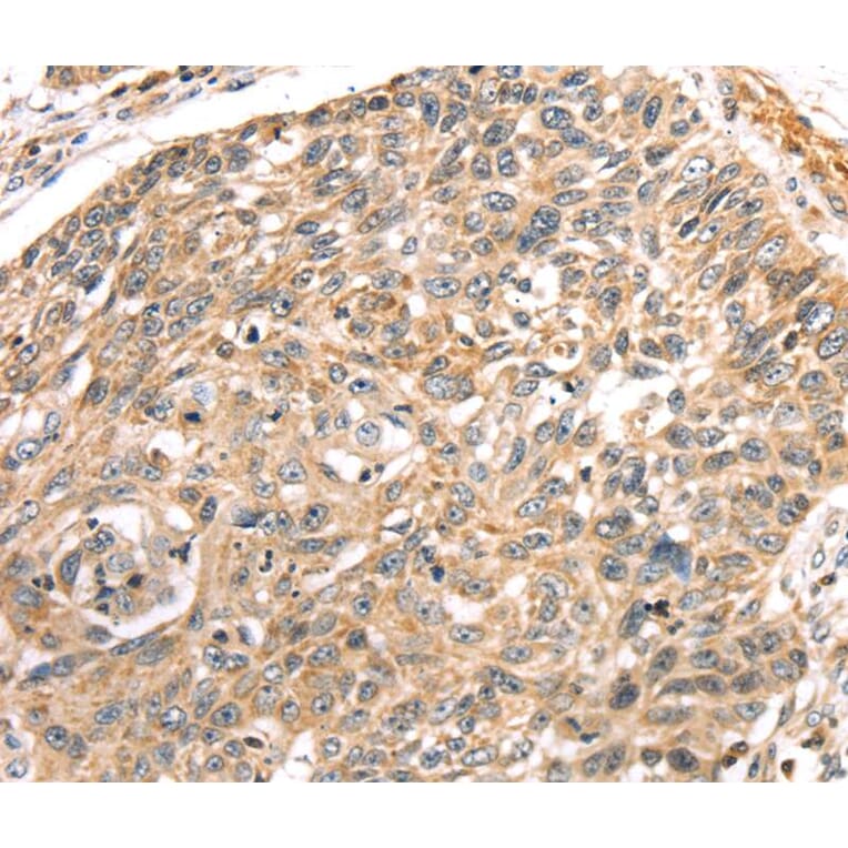 Immunohistochemistry - LONP1 Antibody from Signalway Antibody (40199) - Antibodies.com