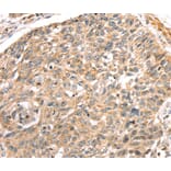 Immunohistochemistry - LONP1 Antibody from Signalway Antibody (40199) - Antibodies.com