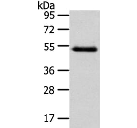 NR2F2 Antibody from Signalway Antibody (40203) - Antibodies.com