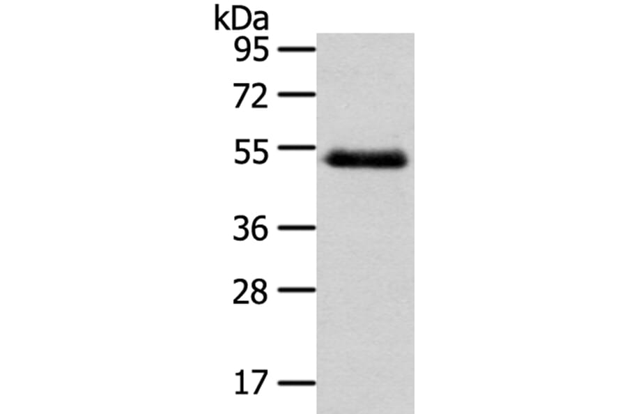 NR2F2 Antibody from Signalway Antibody (40203) - Antibodies.com
