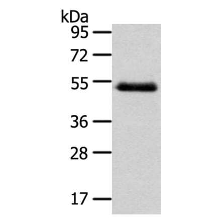 NR2F2 Antibody from Signalway Antibody (40203) - Antibodies.com