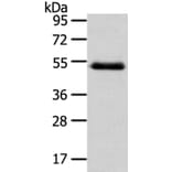 NR2F2 Antibody from Signalway Antibody (40203) - Antibodies.com