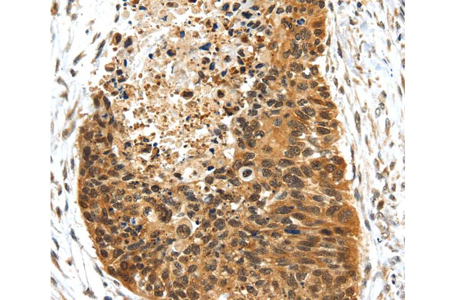 Immunohistochemistry - NR2F2 Antibody from Signalway Antibody (40203) - Antibodies.com