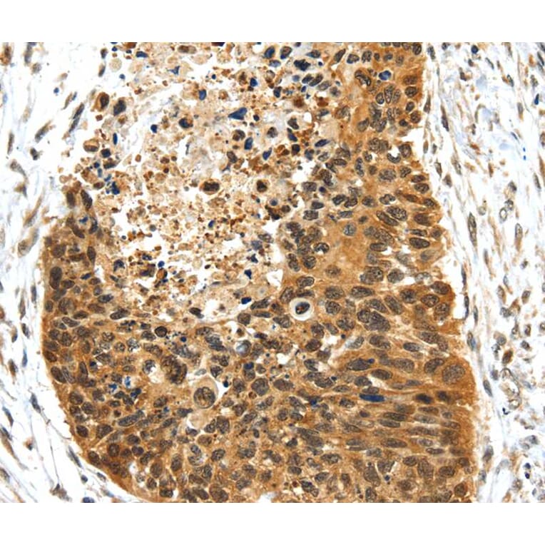 Immunohistochemistry - NR2F2 Antibody from Signalway Antibody (40203) - Antibodies.com