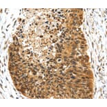 Immunohistochemistry - NR2F2 Antibody from Signalway Antibody (40203) - Antibodies.com