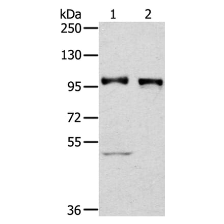 PROX1 Antibody from Signalway Antibody (40209) - Antibodies.com