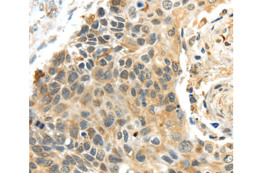 Immunohistochemistry - PROX1 Antibody from Signalway Antibody (40209) - Antibodies.com