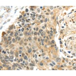 Immunohistochemistry - PROX1 Antibody from Signalway Antibody (40209) - Antibodies.com