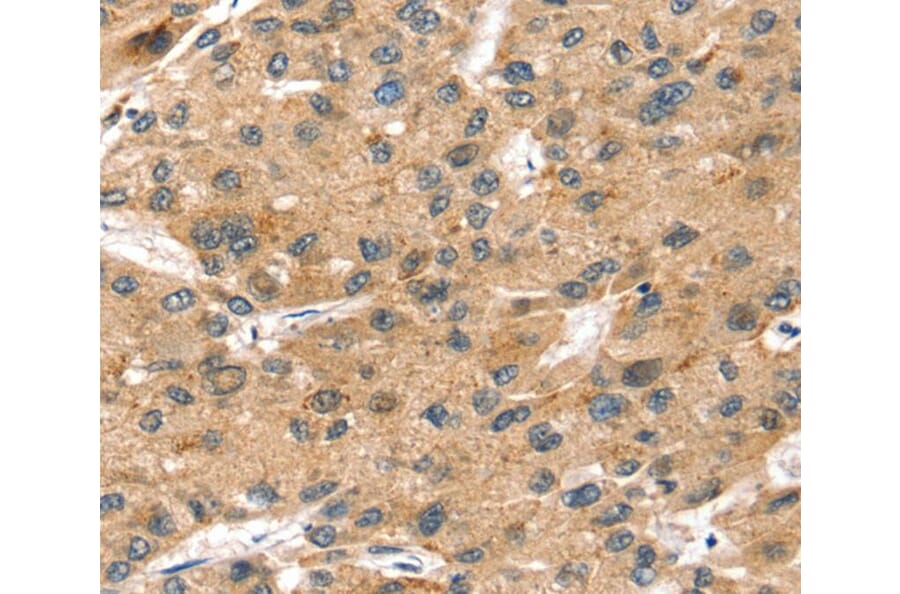 Immunohistochemistry - SORT1 Antibody from Signalway Antibody (40218) - Antibodies.com