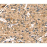 Immunohistochemistry - SORT1 Antibody from Signalway Antibody (40218) - Antibodies.com