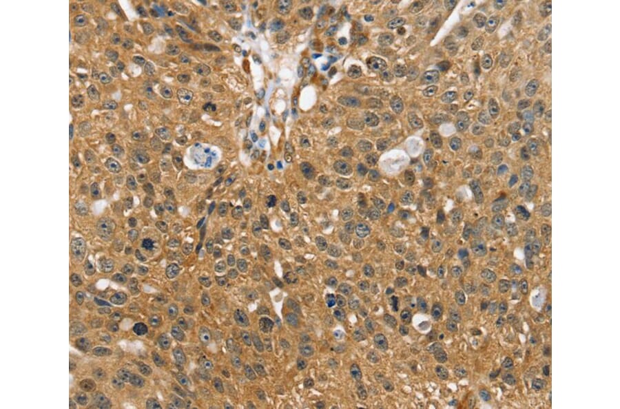 Immunohistochemistry - SORT1 Antibody from Signalway Antibody (40218) - Antibodies.com
