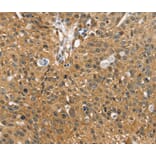 Immunohistochemistry - SORT1 Antibody from Signalway Antibody (40218) - Antibodies.com