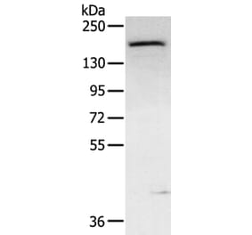ABCC9 Antibody from Signalway Antibody (40229) - Antibodies.com