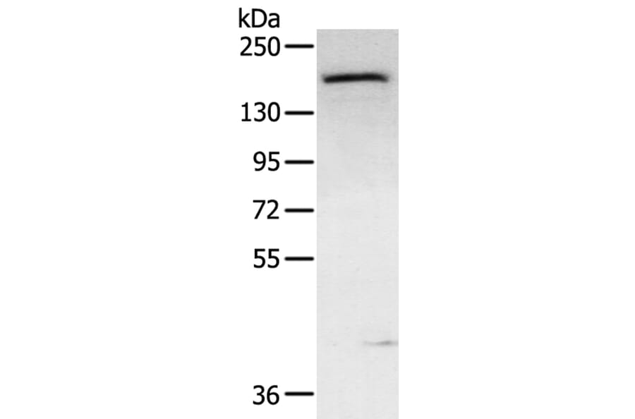ABCC9 Antibody from Signalway Antibody (40229) - Antibodies.com
