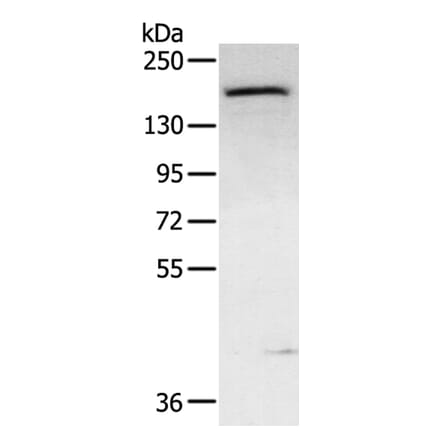 ABCC9 Antibody from Signalway Antibody (40229) - Antibodies.com