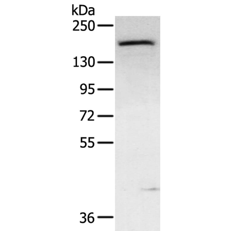 ABCC9 Antibody from Signalway Antibody (40229) - Antibodies.com