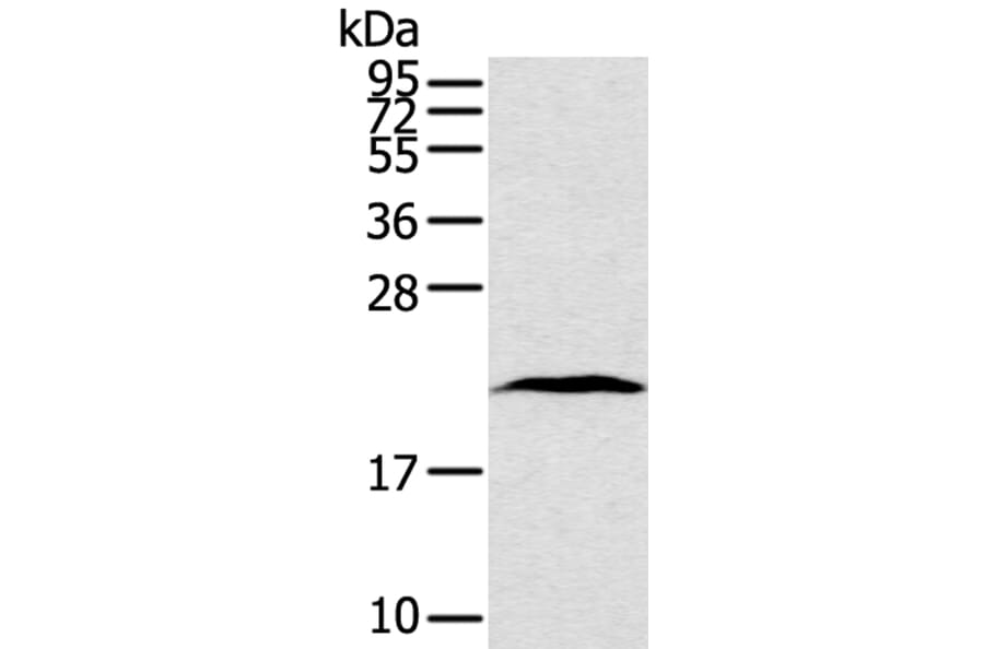 TAF10 Antibody from Signalway Antibody (40234) - Antibodies.com