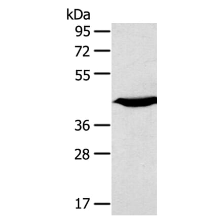 KCNK3 Antibody from Signalway Antibody (40236) - Antibodies.com
