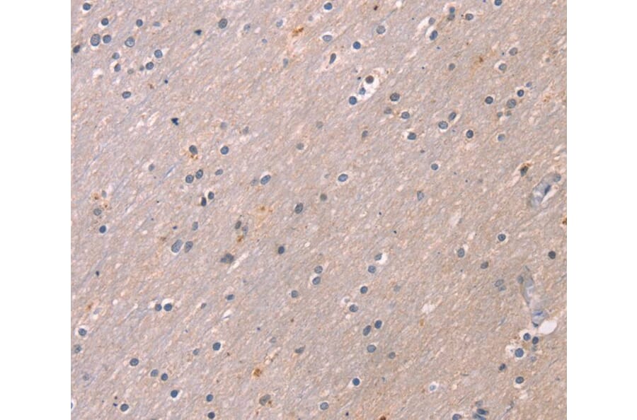 Immunohistochemistry - KCNK3 Antibody from Signalway Antibody (40236) - Antibodies.com