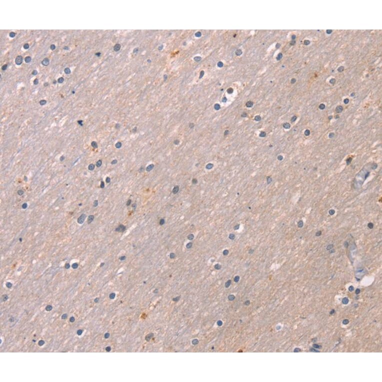 Immunohistochemistry - KCNK3 Antibody from Signalway Antibody (40236) - Antibodies.com