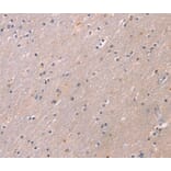 Immunohistochemistry - KCNK3 Antibody from Signalway Antibody (40236) - Antibodies.com