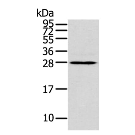 THAP3 Antibody from Signalway Antibody (40242) - Antibodies.com