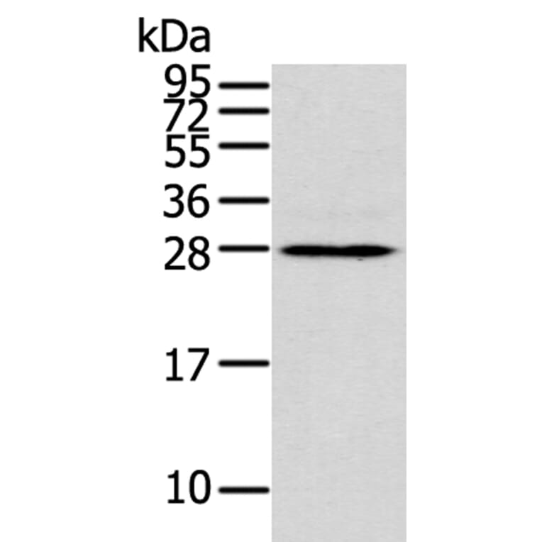 THAP3 Antibody from Signalway Antibody (40242) - Antibodies.com