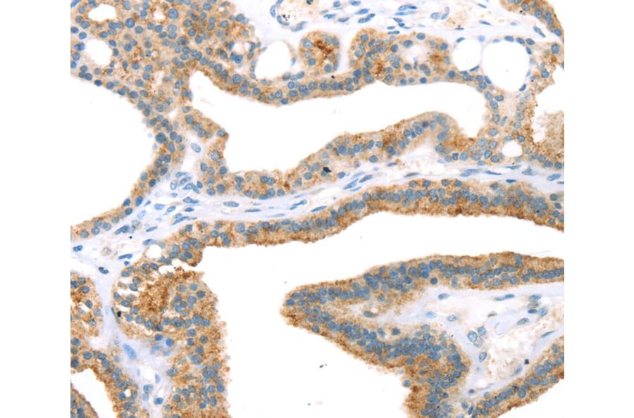 Immunohistochemistry - TNIP2 Antibody from Signalway Antibody (40257) - Antibodies.com