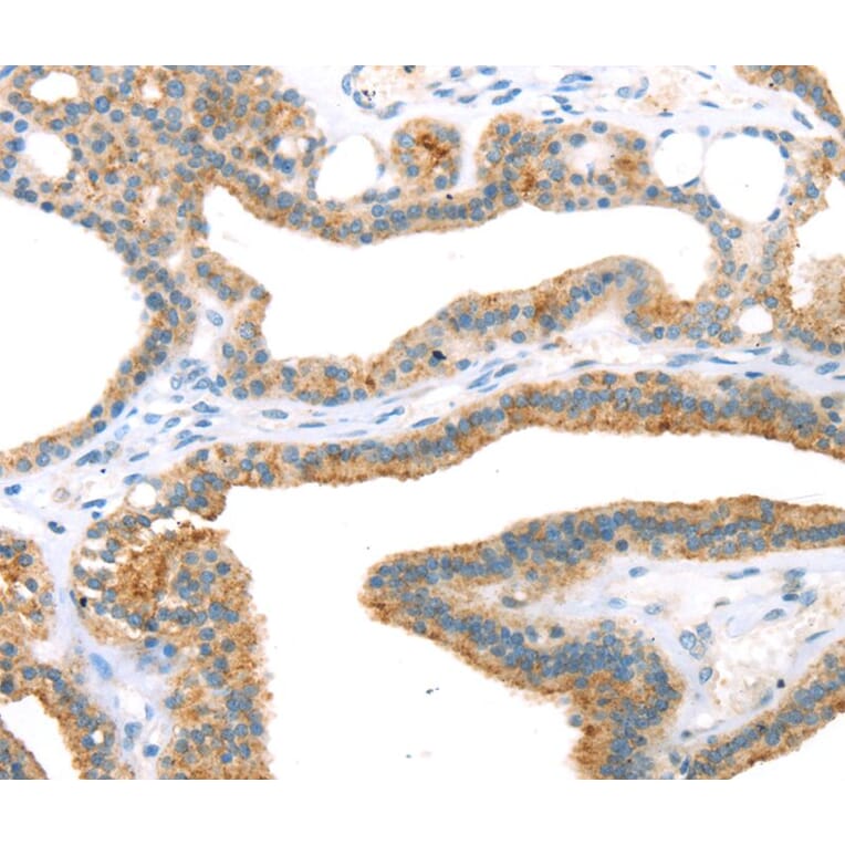 Immunohistochemistry - TNIP2 Antibody from Signalway Antibody (40257) - Antibodies.com