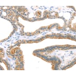Immunohistochemistry - TNIP2 Antibody from Signalway Antibody (40257) - Antibodies.com