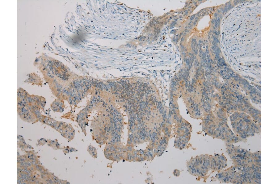 Immunohistochemistry - TNIP1 Antibody from Signalway Antibody (40258) - Antibodies.com