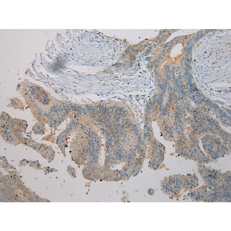 Immunohistochemistry - TNIP1 Antibody from Signalway Antibody (40258) - Antibodies.com