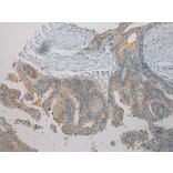 Immunohistochemistry - TNIP1 Antibody from Signalway Antibody (40258) - Antibodies.com