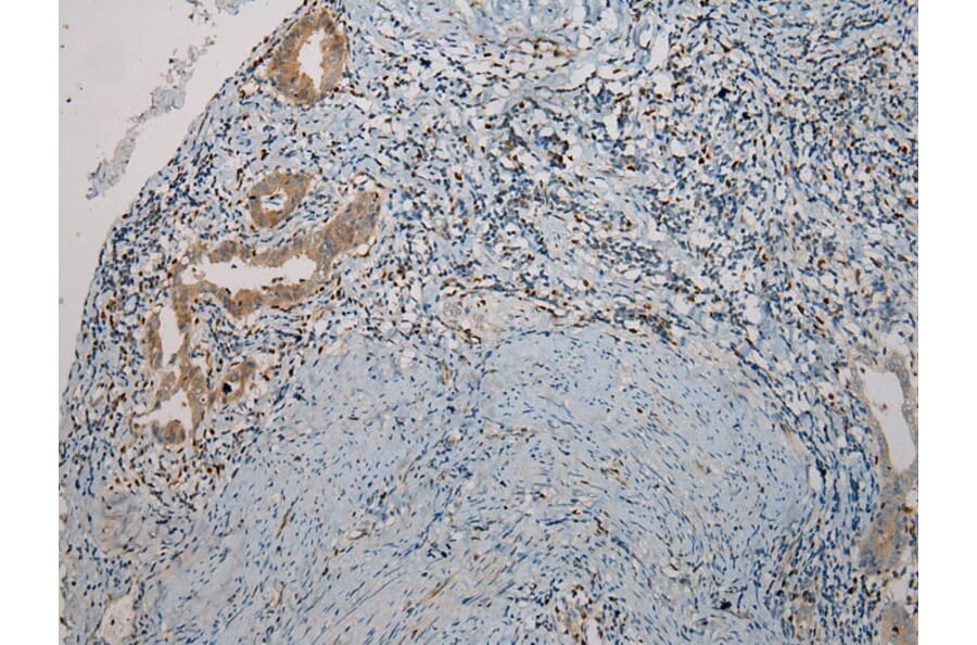 Immunohistochemistry - TNIP1 Antibody from Signalway Antibody (40258) - Antibodies.com