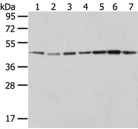 ERP44 Antibody from Signalway Antibody (40273) - Antibodies.com