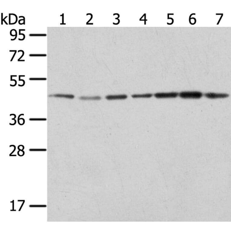 ERP44 Antibody from Signalway Antibody (40273) - Antibodies.com