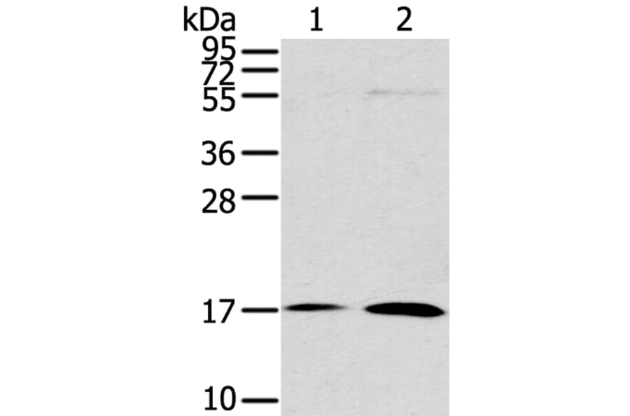 UTS2B Antibody from Signalway Antibody (40287) - Antibodies.com