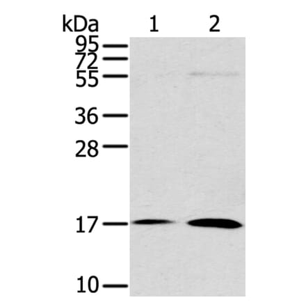 UTS2B Antibody from Signalway Antibody (40287) - Antibodies.com