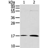 UTS2B Antibody from Signalway Antibody (40287) - Antibodies.com