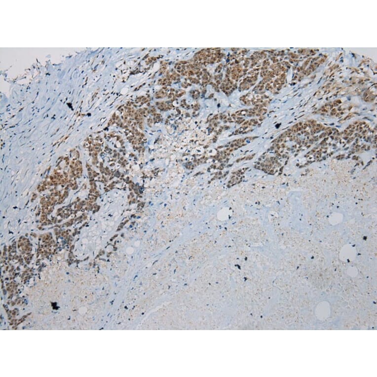 Immunohistochemistry - UTS2B Antibody from Signalway Antibody (40287) - Antibodies.com