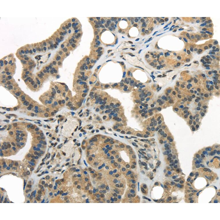 Immunohistochemistry - WDR36 Antibody from Signalway Antibody (40299) - Antibodies.com
