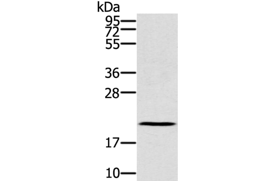 RBBP9 Antibody from Signalway Antibody (40319) - Antibodies.com