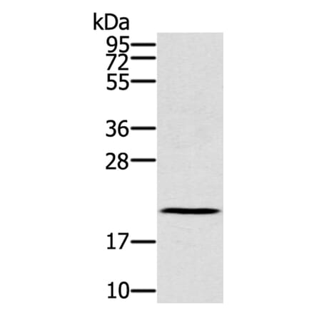 RBBP9 Antibody from Signalway Antibody (40319) - Antibodies.com