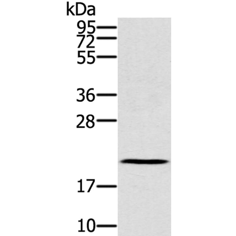 RBBP9 Antibody from Signalway Antibody (40319) - Antibodies.com