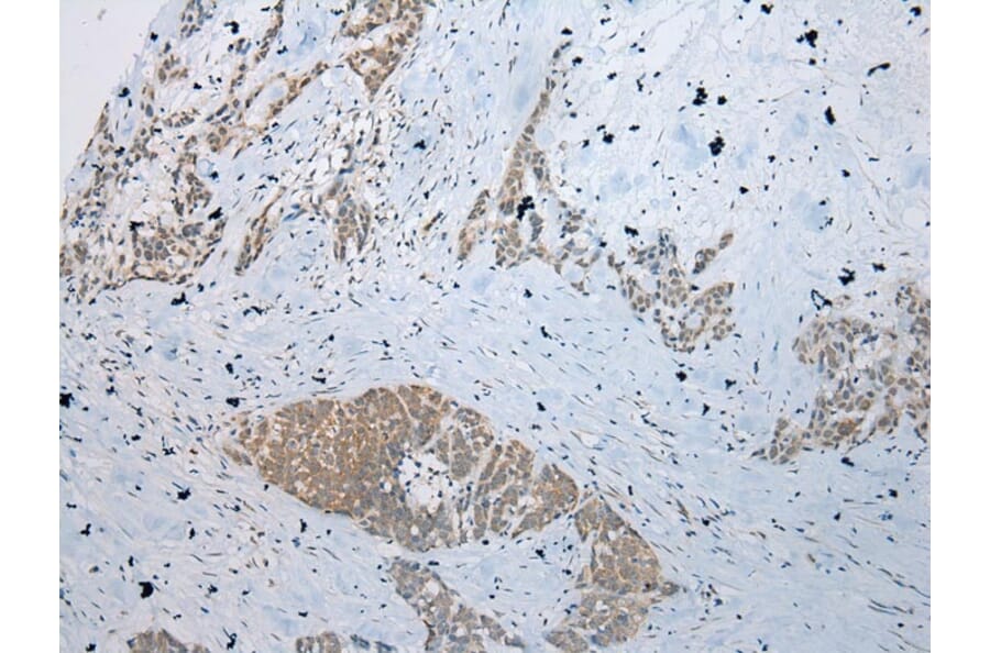 Immunohistochemistry - RBBP9 Antibody from Signalway Antibody (40319) - Antibodies.com