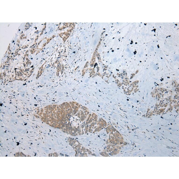 Immunohistochemistry - RBBP9 Antibody from Signalway Antibody (40319) - Antibodies.com