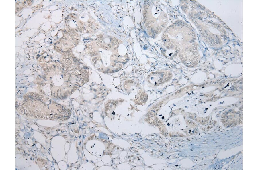 Immunohistochemistry - RBBP9 Antibody from Signalway Antibody (40319) - Antibodies.com
