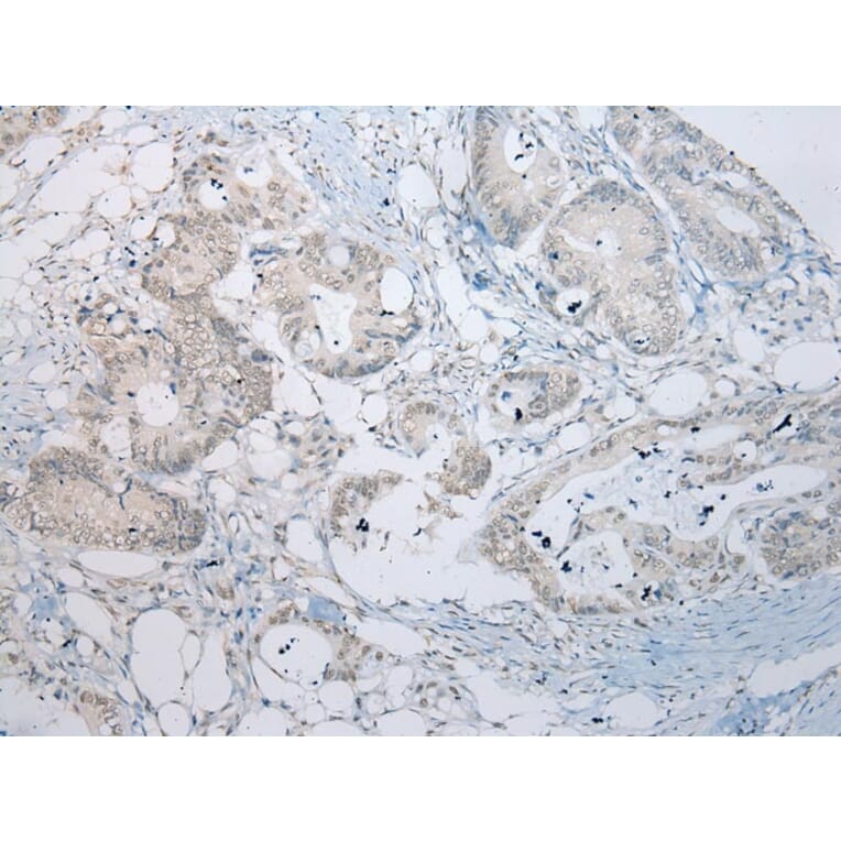 Immunohistochemistry - RBBP9 Antibody from Signalway Antibody (40319) - Antibodies.com